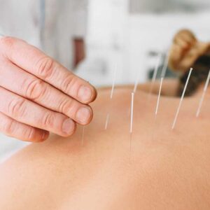 Acupuncture Training
