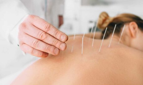 Acupuncture Training